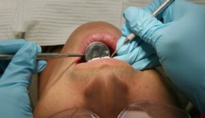 Coralville dentist repeatedly over-diagnosed patients